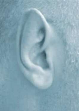 Long thin ear after otoplasty 